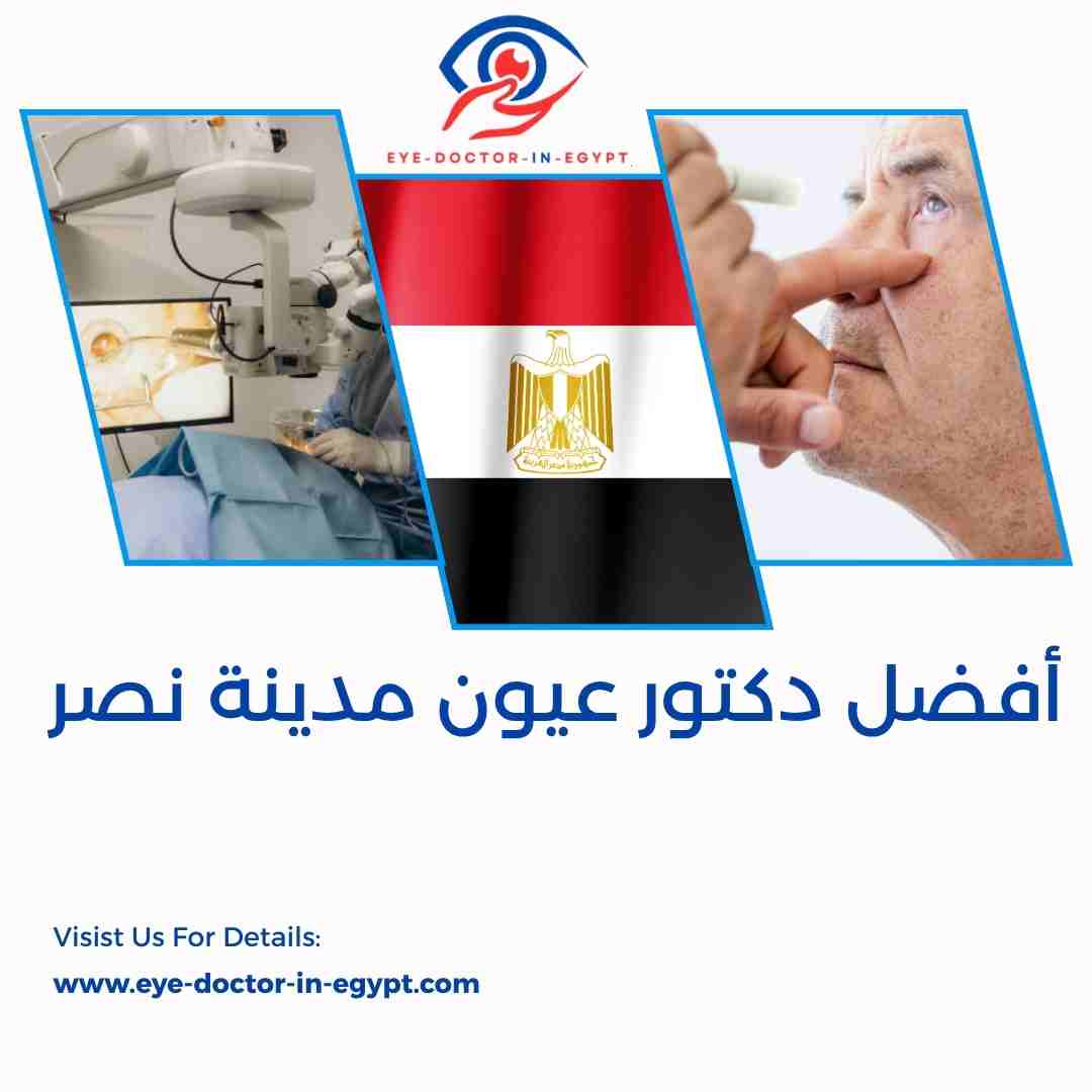 أفضل دكتور عيون مدينة نصر