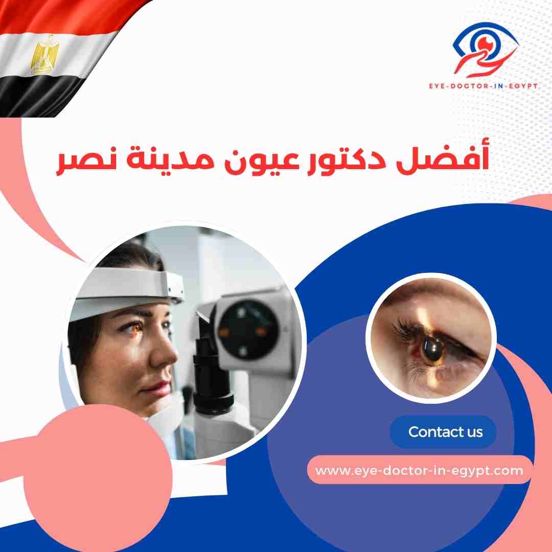 أفضل دكتور عيون مدينة نصر
