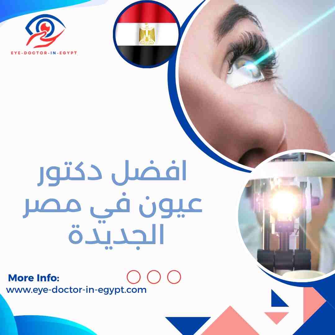 افضل دكتور عيون في مصر الجديدة