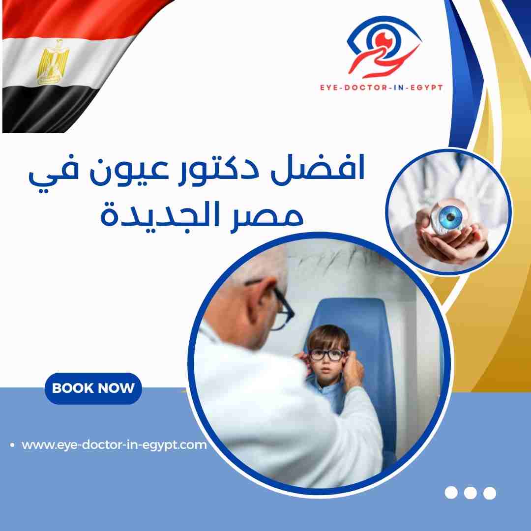 افضل دكتور عيون في مصر الجديدة