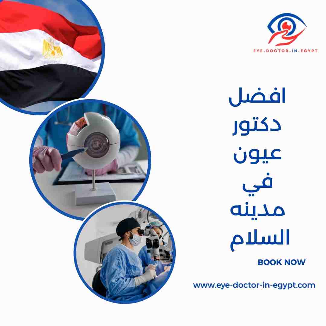 افضل دكتور عيون في مدينه السلام